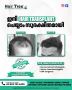 Safest Hair Transplantation Clinic in Kerala — Hair Tree
