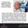 Revive Your Look with the Best Hair Transplant in Noida