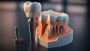 Get Strong, Beautiful Teeth with Dental Implants in Tampa