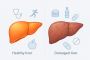 Can Liver Damage Be Reversed? Understanding What’s Possible 