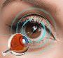Precision Eye Surgeries at Best Eye Hospital in Mumbai