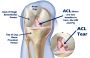 Orthosport Hospital:Complete OrthopedicSolutionsin Ahmedabad