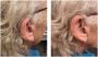 Private Hearing Aids in Wellesbourne