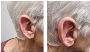 Best Private Hearing Aids Services in Leamington Spa  