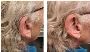 Professional Private Hearing Aids in Leamington Spa