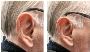 Discover The Best Private Hearing Aids in Leamington Spa