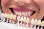  Teeth Whitening Brunswick | Hope Street Family Dental