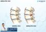 Dr. Tarak Patel- Herniated Disc Treatment in Ahmedabad