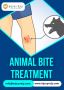 Animal Bite Treatment Available – Secure Your Spot Now