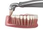 Get Wisdom Tooth Surgery in Thane for Optimal Care