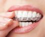 Get a Pain-Free Experience with the Best Dental Clinic in Th