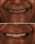 Best Dental Clinic in Ahmedabad