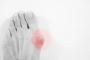 Bunion in big toe treatment