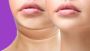 Kin Filler | Achieve Youthful, Natural-Looking Skin