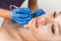 Permanent hair removal North Vancouver Permanent hair removal North Vancouver
