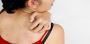 Expert Skin Allergy Treatment by Dr. Jaya Gupta