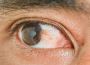 Get Clear Vision with Eye Pterygium Surgery