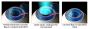Laser Precision Meets Vision Correction Through Eye Surgery