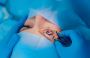 Gain Precision With Refractive Lens Exchange 