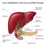 Looking for affordable gall bladder stone operation in Noida
