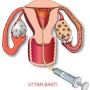 Are you Finding a Uttarbasti Karma Treatment Clinic in Rajko
