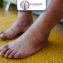 Best Gangrene Treatment in Gujarat, India with Dr. Krunal Go