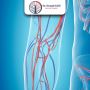 Best Vascular surgeon Gujarat, India - Dr. Krunal Gohil
