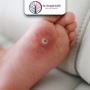 Dr. Krunal Gohil – Diabetic Foot Specialist in Gujarat