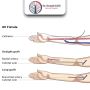 Dr. Krunal Gohil - Best AV Fistula Surgeon in Gujarat, India