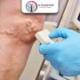 Advanced Care for Vascular Injuries by a Trusted Vascular Sp