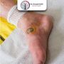 Best Diabetic Foot Treatment in Ahmedabad, India for Long-Te