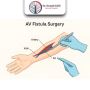 Consult the Best AV Fistula Surgeon in Ahmedabad, India – Dr