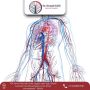 Best Vascular Surgeon in Ahmedabad, India for Injury Care