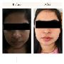 Top Laser Treatment in Ahmedabad, Gujarat: Dr. Krupa