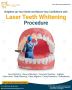 Laser Teeth Whitening in Chandigarh - Lifecare Dental Clinic