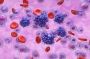 Understanding and Conquering B-Cell Lymphoma