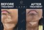 Best Doctor & Effective Homeopathic Vitiligo Treatment.