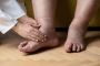 Bunion in big toe Bunion in big toe