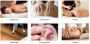 Headache & Migraine Relief with Acupuncture Edmonton South