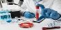Book CBR & CRP Blood Tests at Max Lab | Home Sample Collecti
