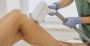 Preparing Your SHR Permanent Hair Removal Session in Perth