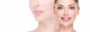 How to Remove Acne from Dry Skin | Consult the Best Dermatol