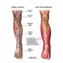  DVT Treatment in Mumbai: Expert Care at Midas Care Clinic
