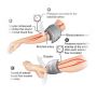 Precise Arterial Doppler Ultrasound at Midas Care Clinic
