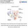 Carotid Doppler Ultrasound: Detect Blockages with Precision