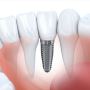 Cosmetic Dentistry Canberra