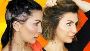 زراعة الشعر في الرياض