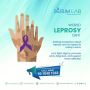 "  World Leprosy Day   Today, on World Leprosy Day, 