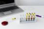 Cortisol ELISA Kit