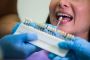 Fix Cavities with Invisible Fillings – Perris Dental Care!